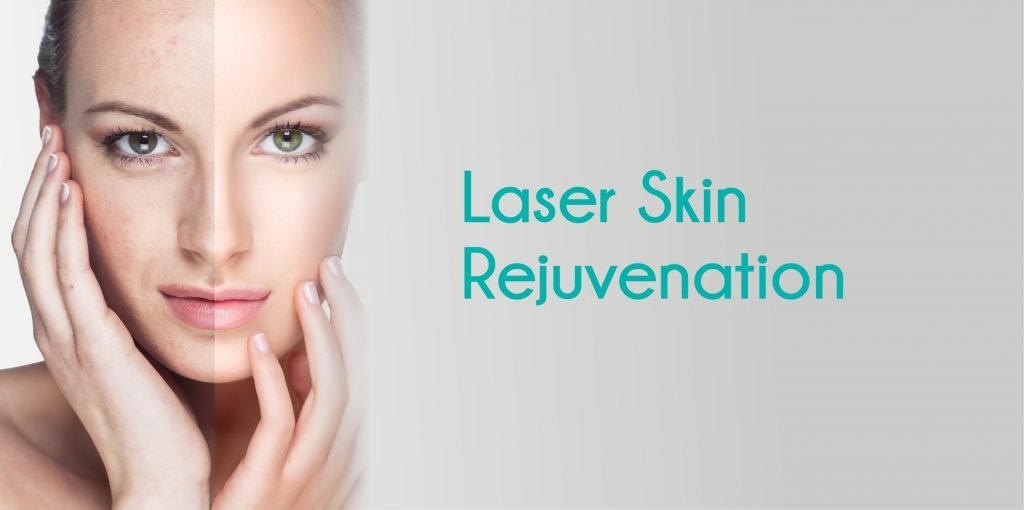 Lasers 101 - Everything You Need To Know About Aesthetic Lasers